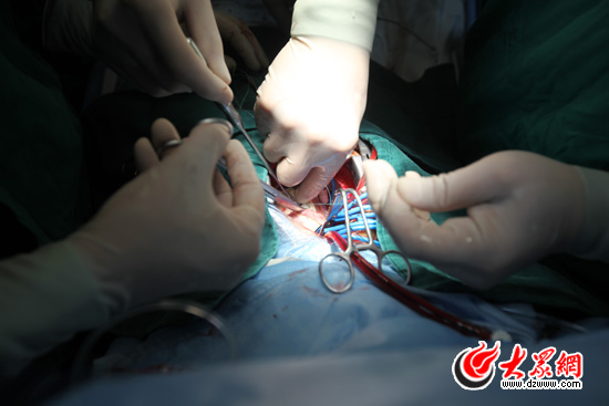 �c(di��n)���g�[��һ��